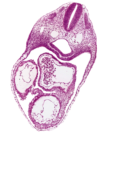 common atrium, dermatomyotome 4 (O-4) , ectodermal ring, left ventricle, pericardial cavity, rhombencephalon (Rh. D), rhombencoel (fourth ventricle), right ventricle, sclerotome, ultimopharyngeal pouch