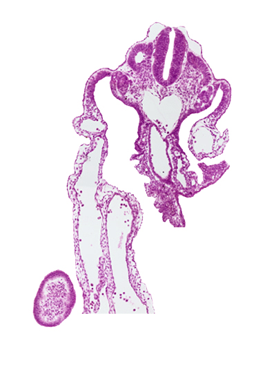 aorta, caudal eminence, caudal intestinal portal, dermatomyotome 12 (C-8), mesonephric duct, mesonephric vesicle(s), presumptive upper limb bud, right umbilical vein