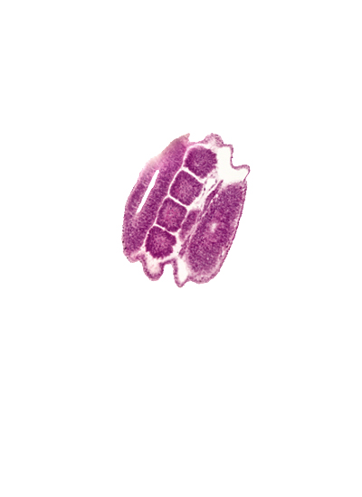 edge of intermediate mesenchyme, somatopleuric mesoderm, somite 19 (T-7), somite 20 (T-8), somite 21 (T-9), somite 22 (T-10), surface ectoderm