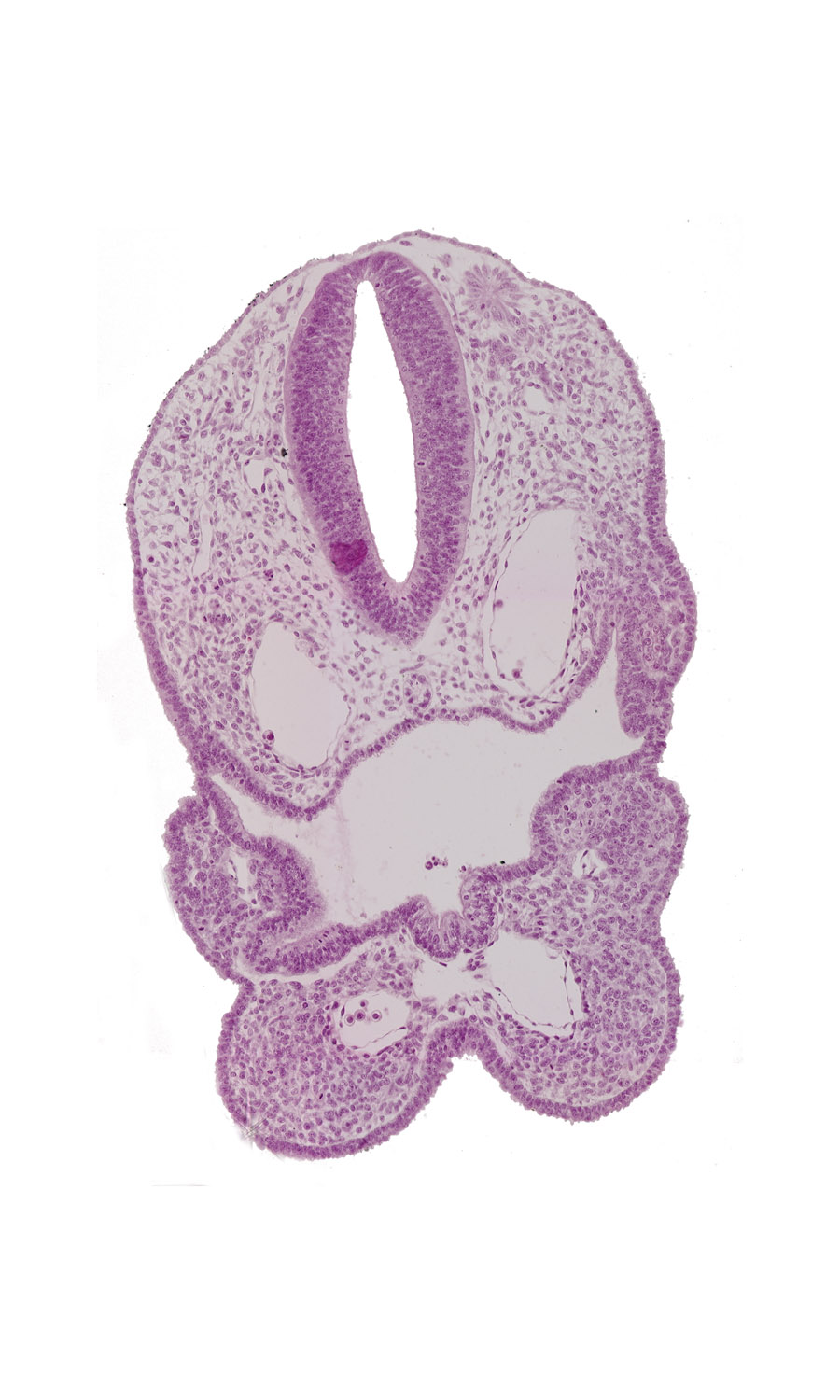 aortic arch 1, aortic arch 2, cervical sinus, dermatomyotome 1 (O-1), ectodermal ring, median mandibular groove, perinotochordal lamina, pharyngeal arch 1, pharyngeal arch 2, pharyngeal arch 3, pharyngeal groove 3, pharyngeal pouch 2, pharyngeal pouch 3, pharynx, rhombencephalon (Rh. D), thyroid diverticulum