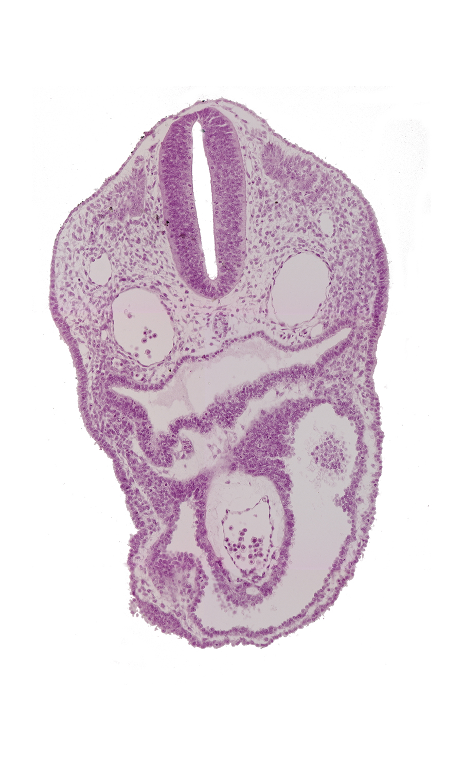 aortic sac, dermatomyotome 2 (O-2) , dorsal aorta, notochord, pericardial cavity, pharyngeal pouch 3, pharynx, rhombencephalon (Rh. D)