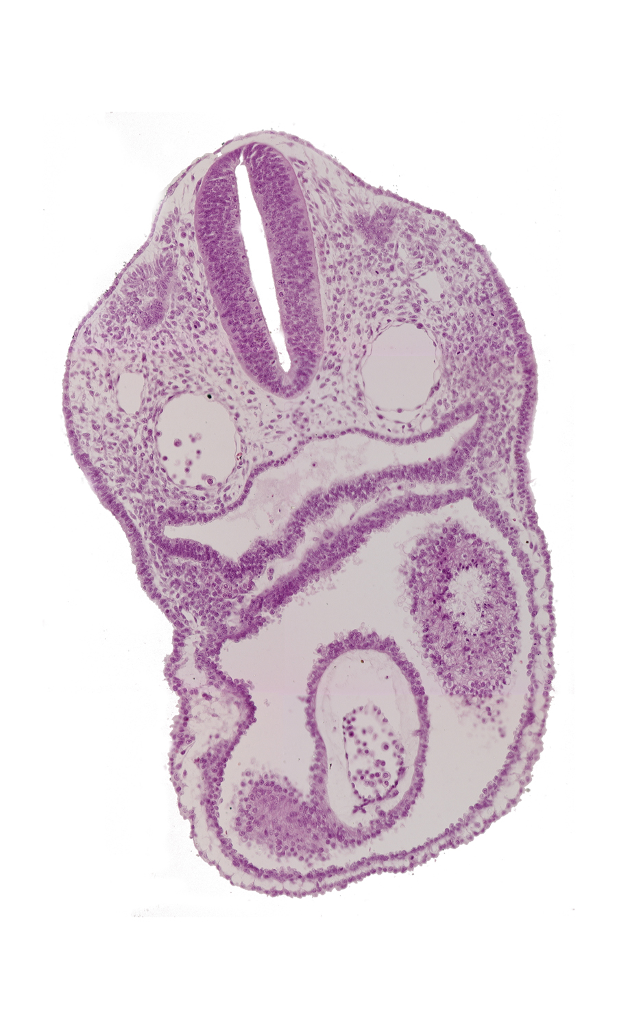 caudal edge of dermatomyotome 2 (O-2), cephalic parts of conus cordis, dorsal aorta, ectodermal ring, junction of conus cordis and truncus arteriosus, left atrium, pericardial cavity, pharyngeal pouch 4 recess, precardinal vein, truncus arteriosus