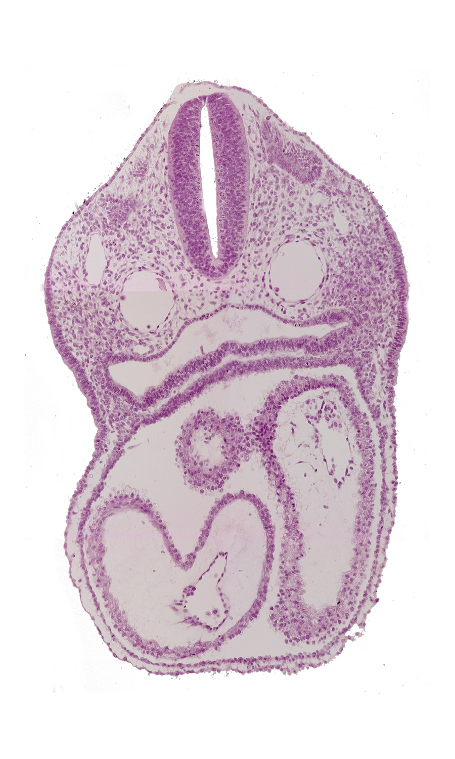 atrioventricular canal, cardiac jelly, conus cordis, dermatomyotome 3 (O-3) , dorsal aorta, ectodermal ring, endocardium, epimyocardium, left atrium, left ventricle, notochord, pericardial cavity, pharyngeal pouch 4, pharynx, precardinal vein, rhombencephalon (Rh. D), right atrium, sclerotome, truncus arteriosus