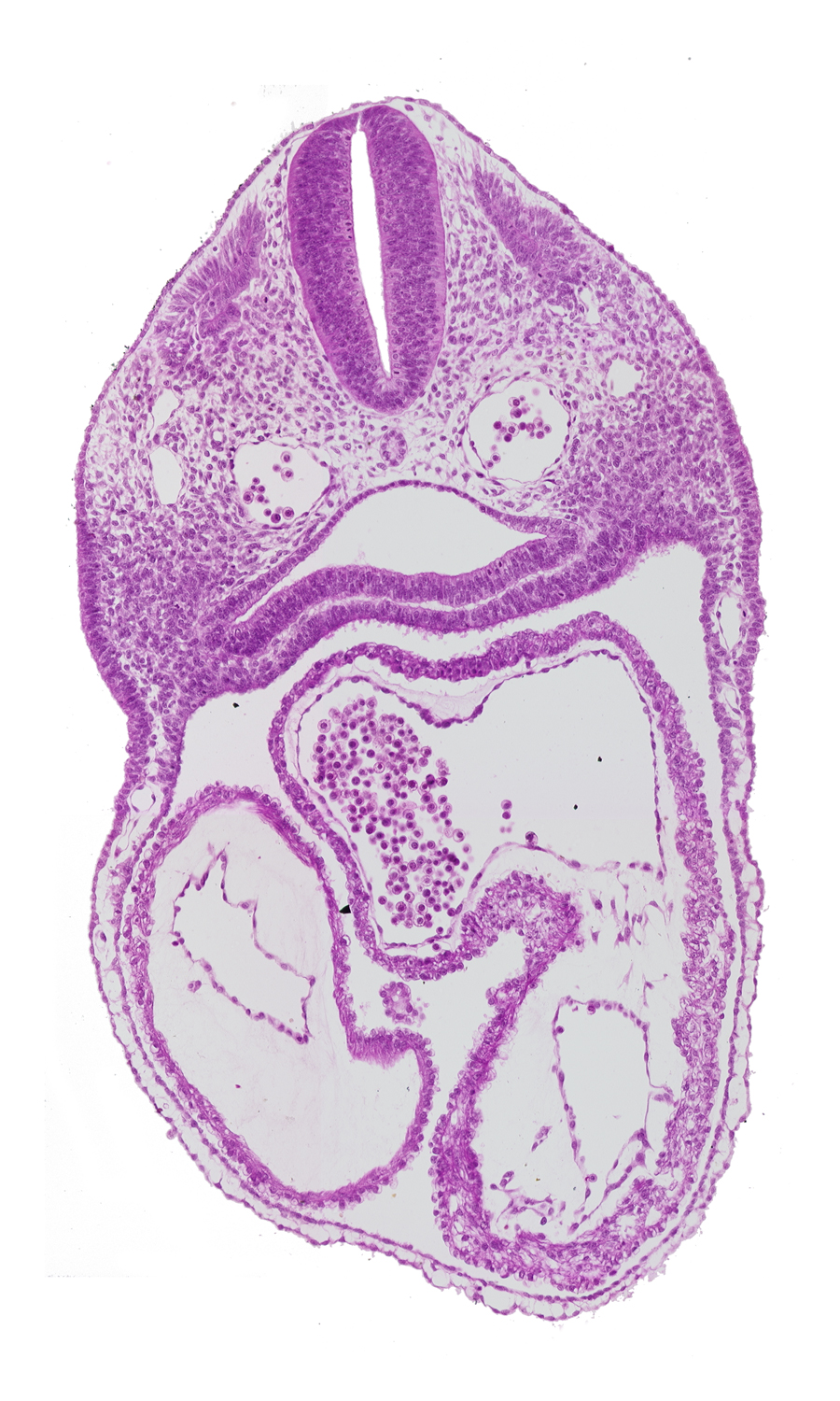 cardiac jelly, conus cordis, dermatomyotome 3 (O-3) , dorsal aorta, ectoderm, interatrial foramen (primum), interatrial sulcus, junction of conus cordis and right ventricle, left atrium, left ventricle, mesoderm, notochord, pericardial cavity, pharynx, rhombencephalon (Rh. D), right atrium, septum primum