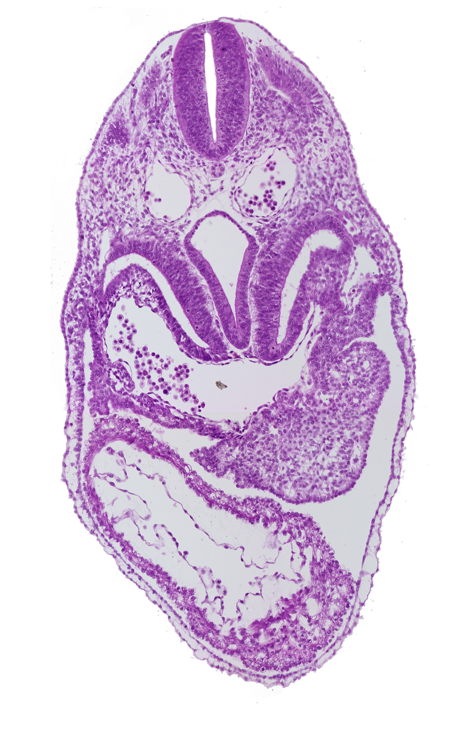 common ventricle, dermatomyotome 5 (C-1), dorsal aorta, foregut, left ventricle, pericardial cavity, pericardial sac, pericardioperitoneal canal (pleural cavity), precardinal vein, respiratory primordium, right horn of sinus venosus, sclerotome, septum transversum, sinus venosus, spinal part of neural tube lumen, surface ectoderm