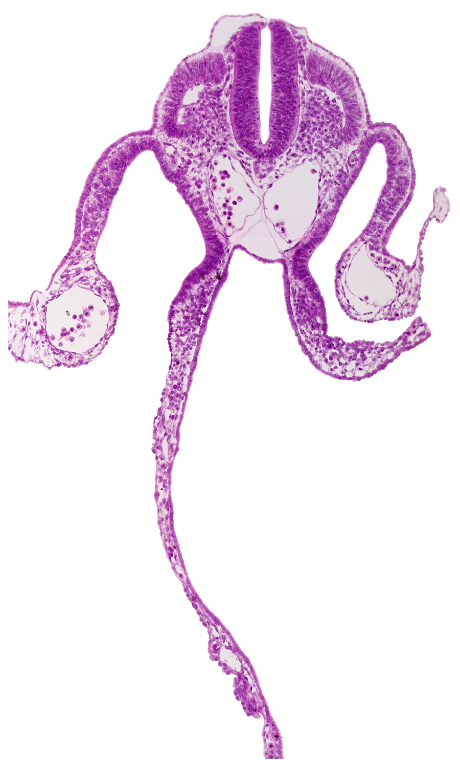 amnion attachment, cephalic extent of mesonephric vesicles, dermatomyotome 9 (C-5), left umbilical vein, midgut, perinotochordal lamina, peritoneal cavity, right umbilical vein, sclerotome, umbilical vesicle cavity