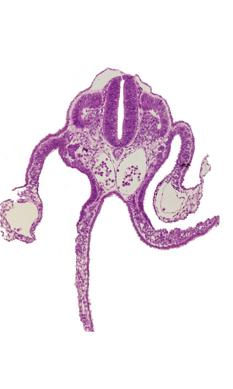 dermatomyotome 10 (C-6), left umbilical vein, notochord, peritoneal cavity, primordial omental bursa, right umbilical vein, sulcus limitans