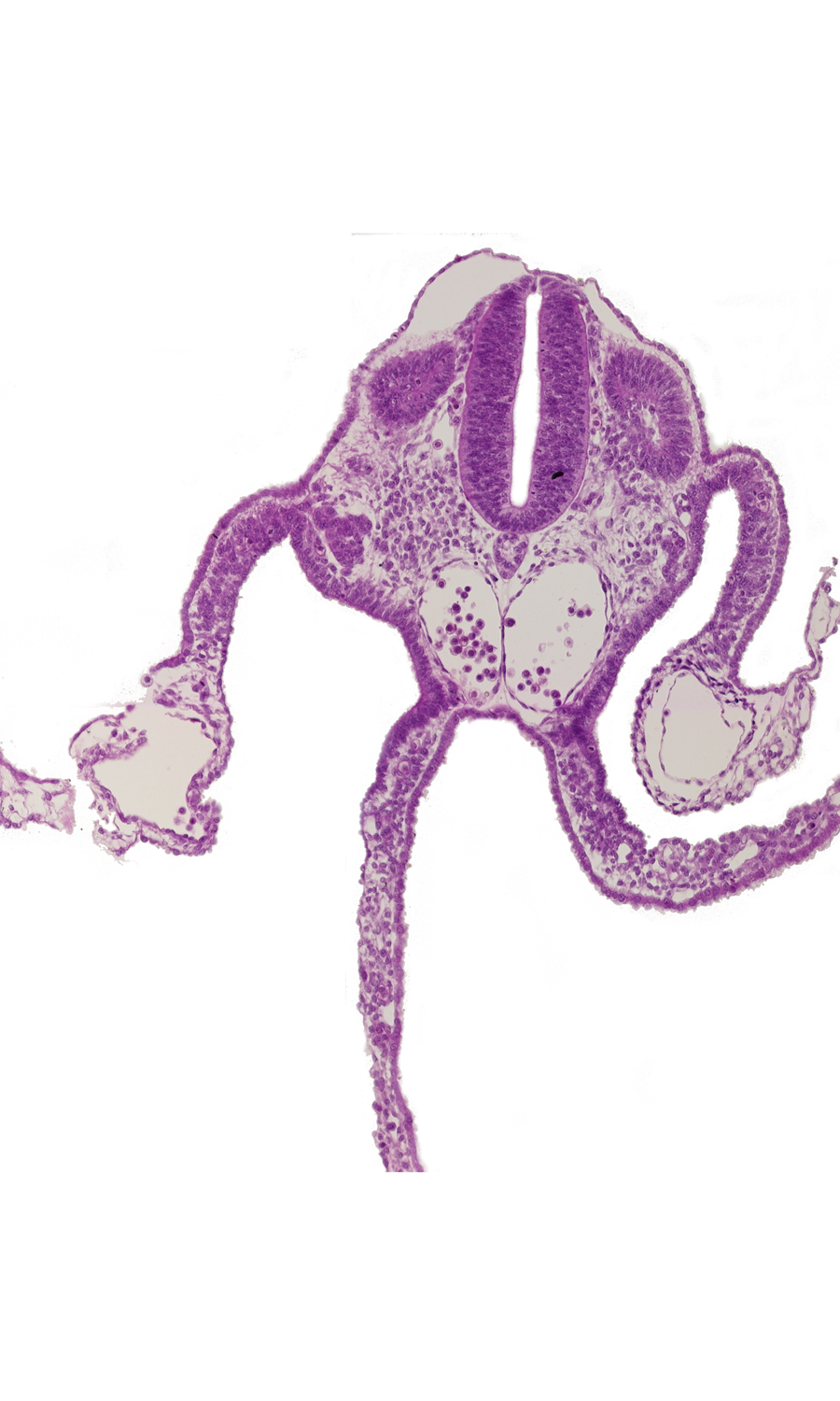 adjacent dorsal aortas, dermatomyotome 10 (C-6), mesonephric duct, mesonephric vesicle(s), midgut, nucleated red blood cells, perinotochordal lamina, primordial omental bursa, sclerotome, separation artifact, somitocoel