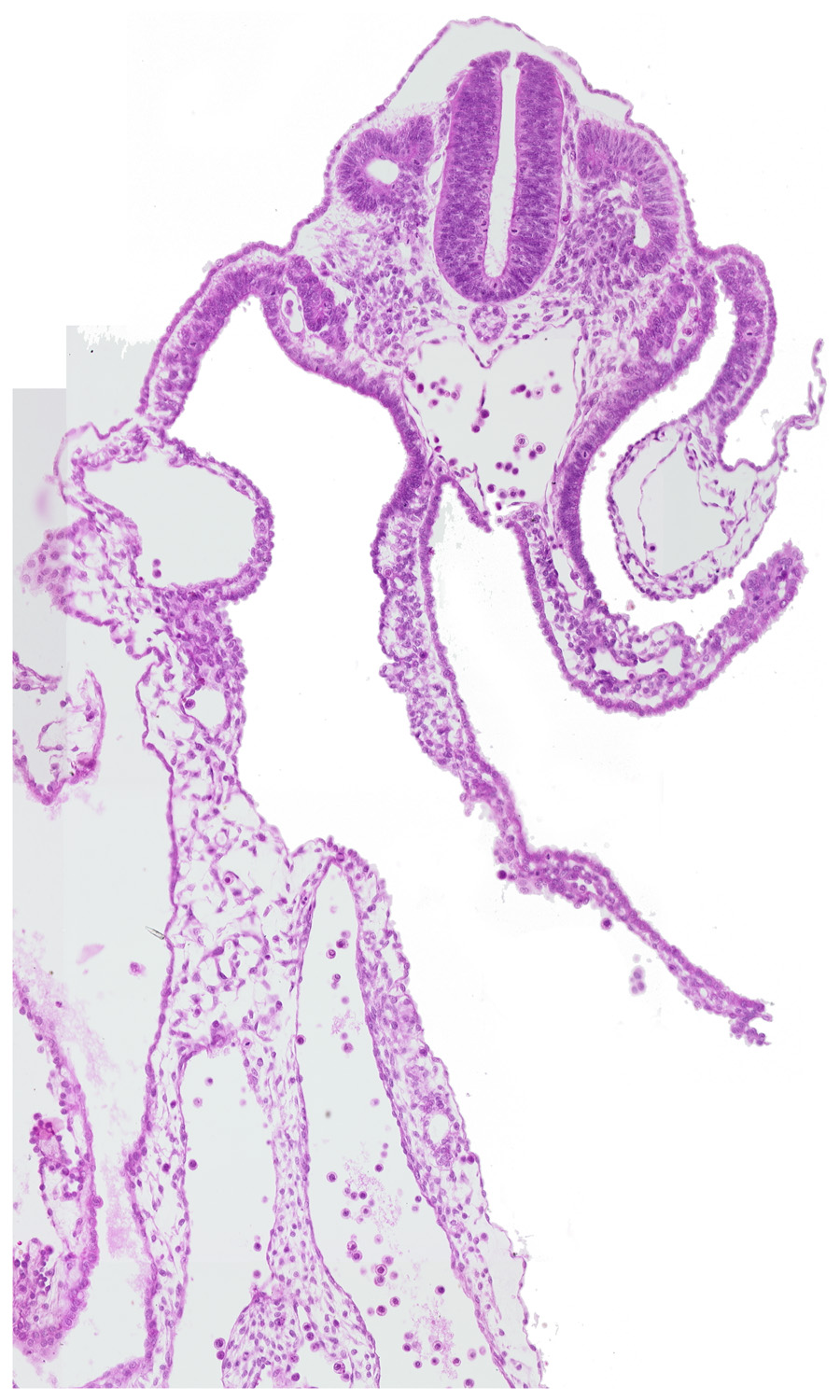 dermatomyotome 11 (C-7), left umbilical vein, right umbilical vein, surface ectoderm