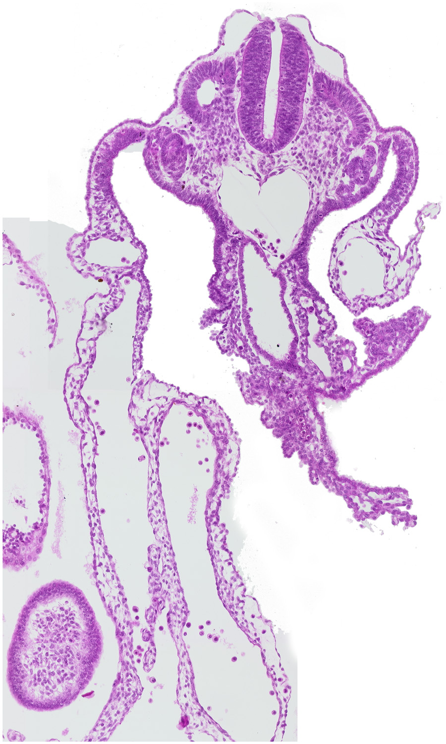 aorta, caudal eminence, caudal intestinal portal, dermatomyotome 12 (C-8), mesonephric duct, mesonephric vesicle(s), presumptive upper limb bud, right umbilical vein