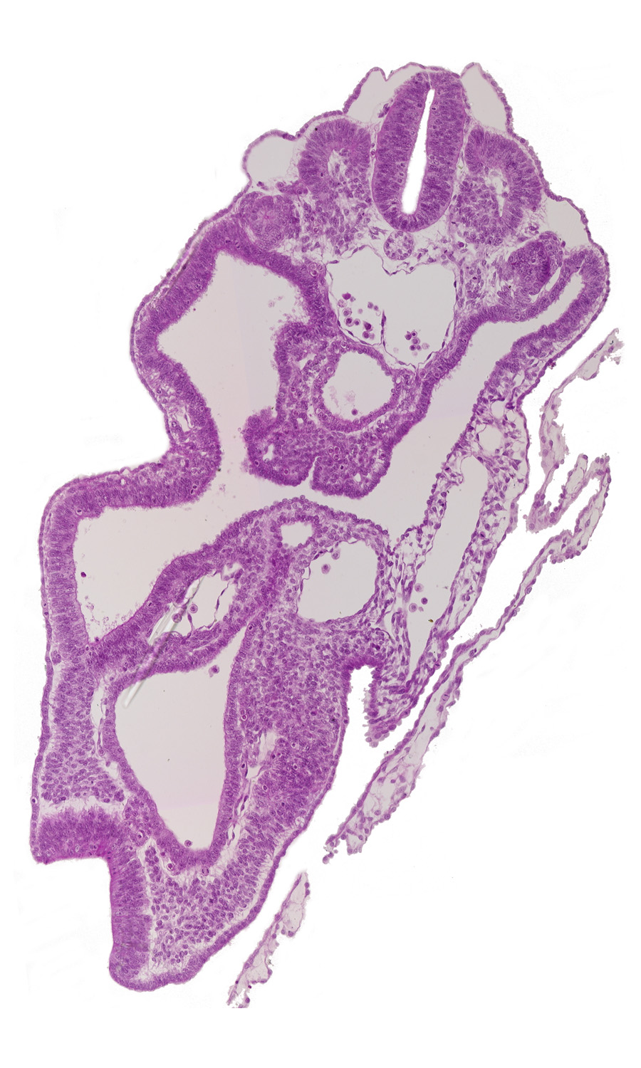 allantois, aorta, cloaca, dermatomyotome 14 (T-2), hindgut, left umbilical artery, left umbilical vein, mesonephric vesicle(s), neural fold, neural plate, notochord, peritoneal cavity, right umbilical artery, sclerotome, somitocoel