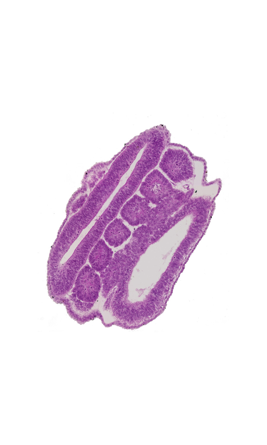 dorsal edge of somite 19 (T-7), dorsal edge of somite 20 (T-8), intersegmental region, mesonephric duct, neural tube wall, roof plate, somite 18 (T-6), somite 19 (T-7), somite 20 (T-8), somite 21 (T-9), somite 22 (T-10), somite 23 (T-11)