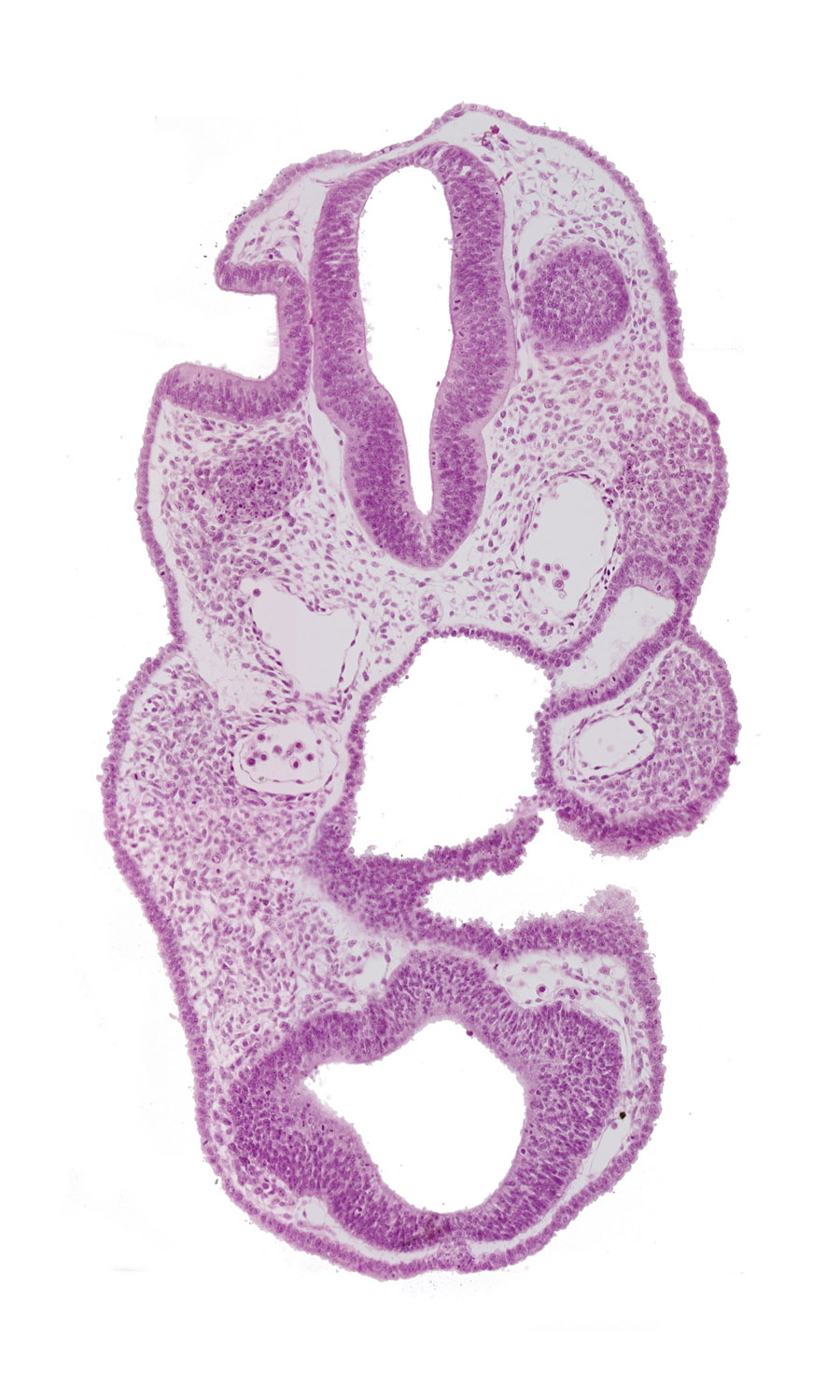 adenohypophysial pouch, aortic arch 1, chiasmatic plate (D1), dorsal aorta, neuropore site, pharyngeal pouch 1, prosencoel (third ventricle), rhombencephalon (Rh. 5), telencephalon medium (T)