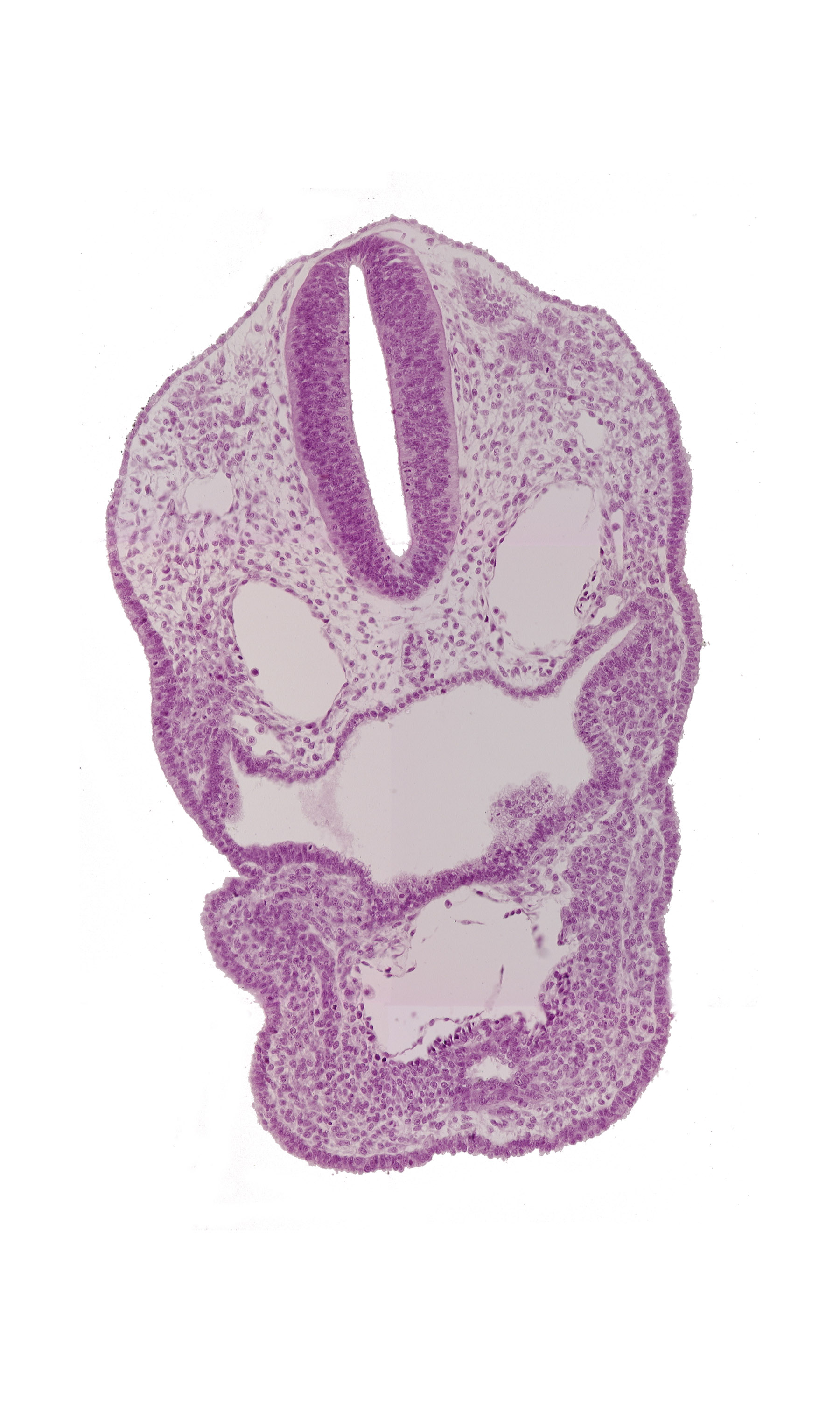 aortic sac, cephalic edge of pericardial sac, dermatomyotome 1 (O-1), dermatomyotome 2 (O-2) , dorsal aorta, ectodermal ring, perinotochordal lamina, pharyngeal arch 3, pharyngeal groove 1, pharyngeal groove 2, pharyngeal groove 3, pharyngeal pouch 3, precardinal vein