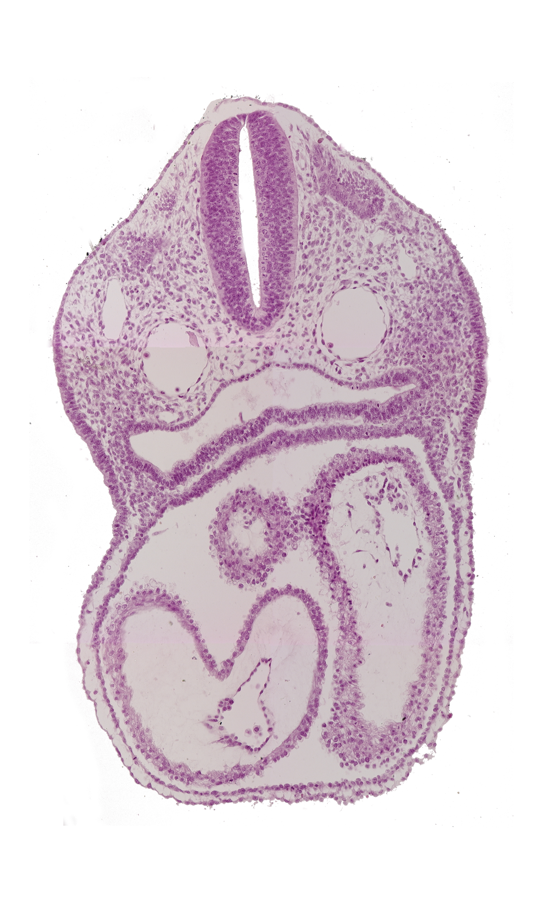 atrioventricular canal, cardiac jelly, conus cordis, dermatomyotome 3 (O-3) , dorsal aorta, ectodermal ring, endocardium, epimyocardium, left atrium, left ventricle, notochord, pericardial cavity, pharyngeal pouch 4, pharynx, precardinal vein, rhombencephalon (Rh. D), right atrium, sclerotome, truncus arteriosus
