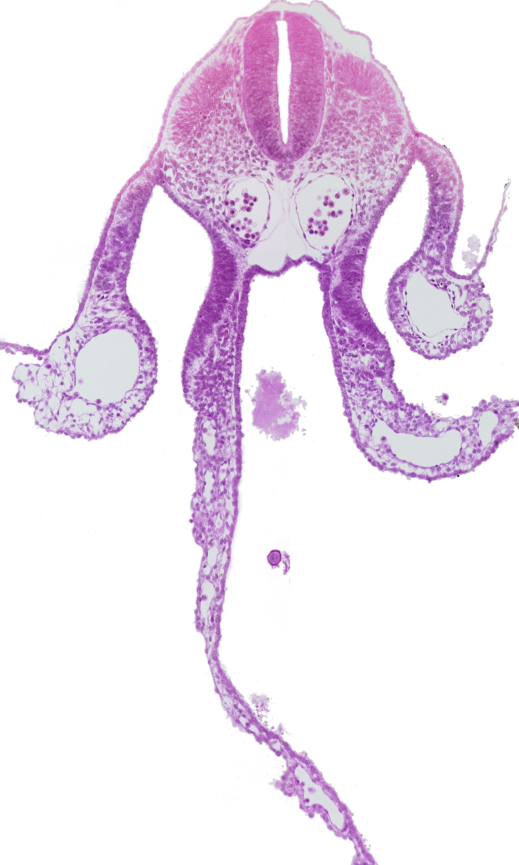 alar plate(s), basal plate, dermatomyotome 8 (C-4), dorsal aorta, floor plate, left vitelline (omphalomesenteric) vein, midgut, neural tube, notochord, peritoneal cavity, roof plate, specialized coelomic wall, sulcus limitans