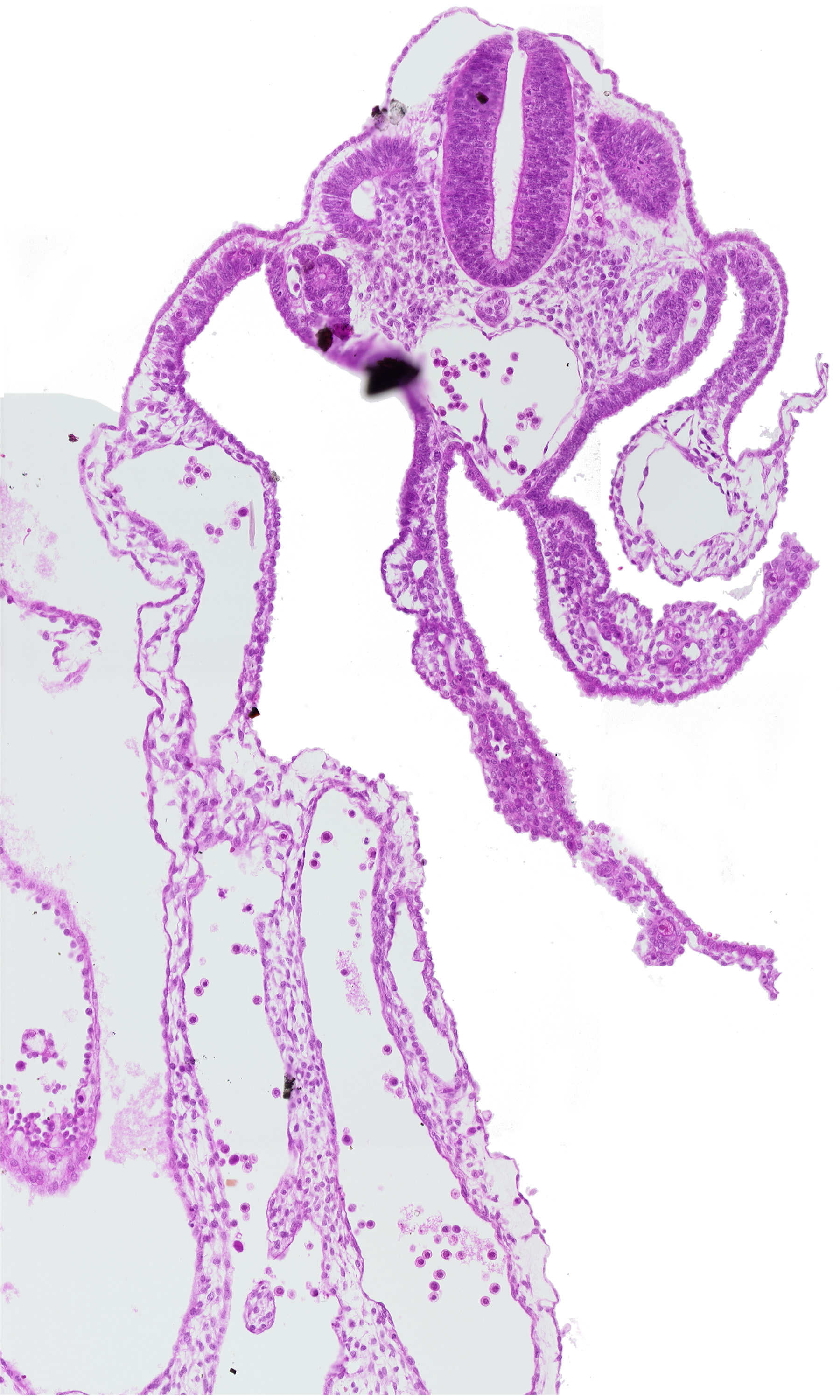common umbilical artery, dermatomyotome 11 (C-7), dorsal aorta, endoderm, mesonephric vesicle(s), midgut, splanchnopleuric mesoderm