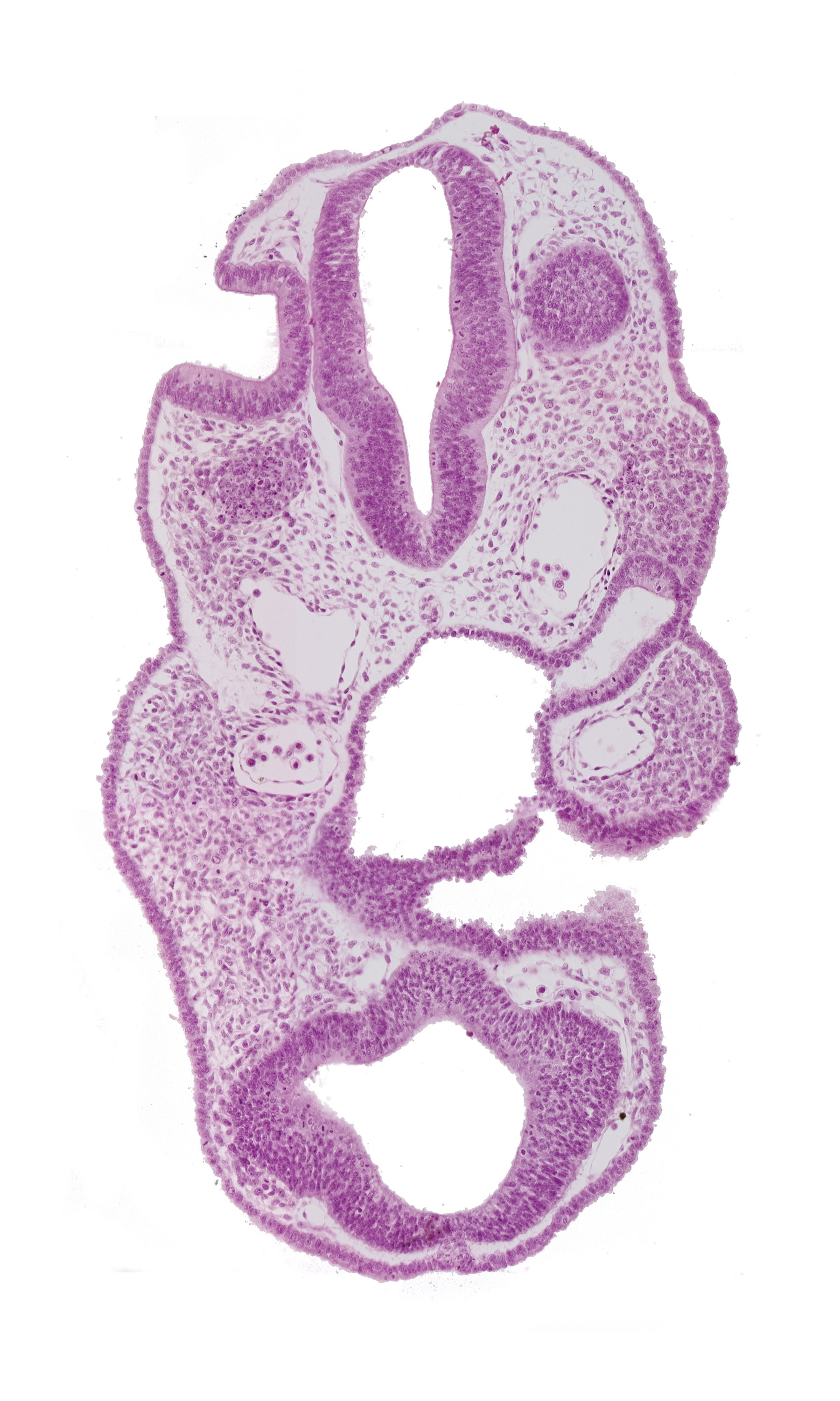 adenohypophysial pouch, aortic arch 1, chiasmatic plate (D1), dorsal aorta, neuropore site, pharyngeal pouch 1, prosencoel (third ventricle), rhombencephalon (Rh. 5), telencephalon medium (T)