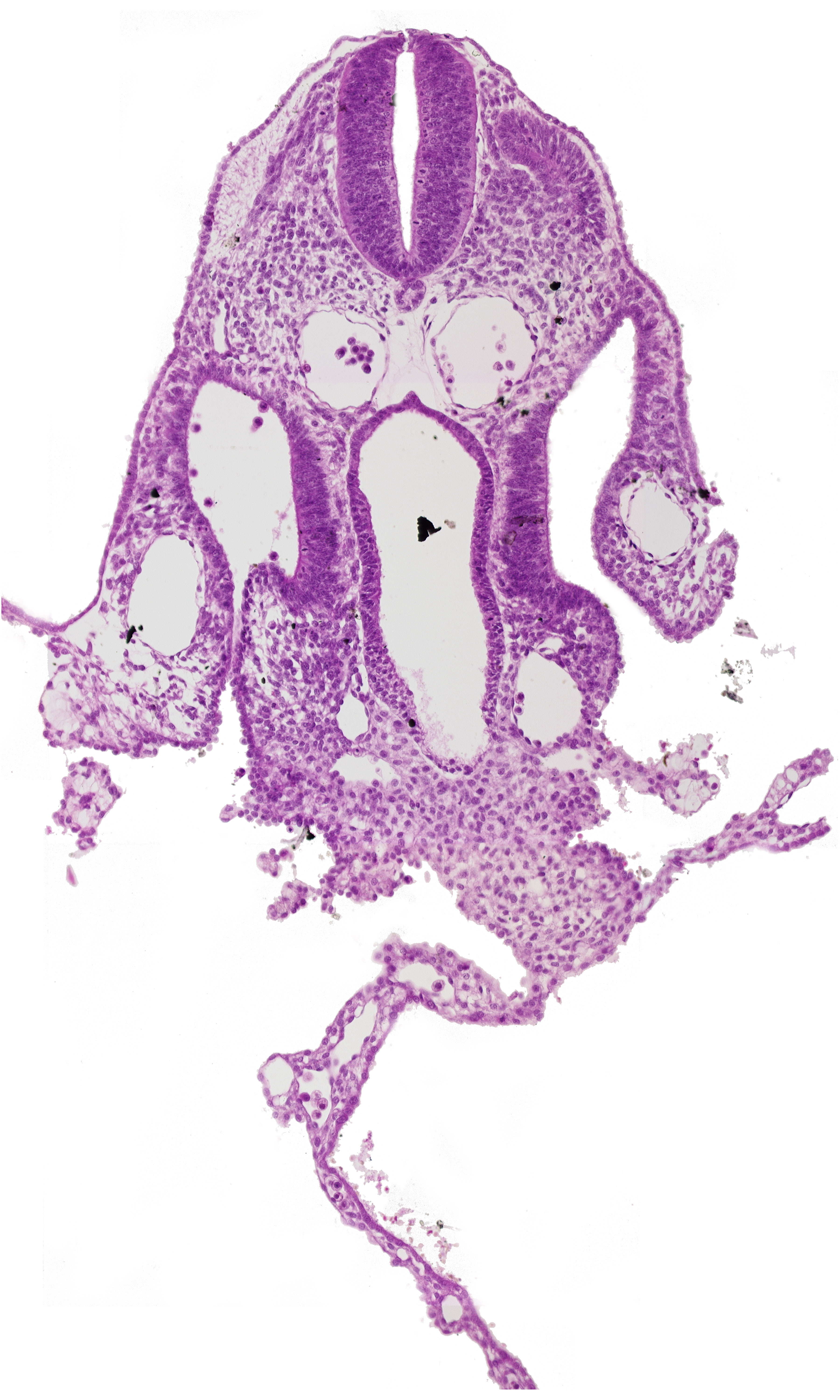 amnion attachment, communication between peritoneal cavity and extra-embryonic coelom, dermatomyotome 7 (C-3), dorsal aorta, extra-embryonic coelom, left umbilical vein, mesothelium of umbilical vesicle, midgut, notochord, right umbilical vein, septum transversum, umbilical vesicle wall