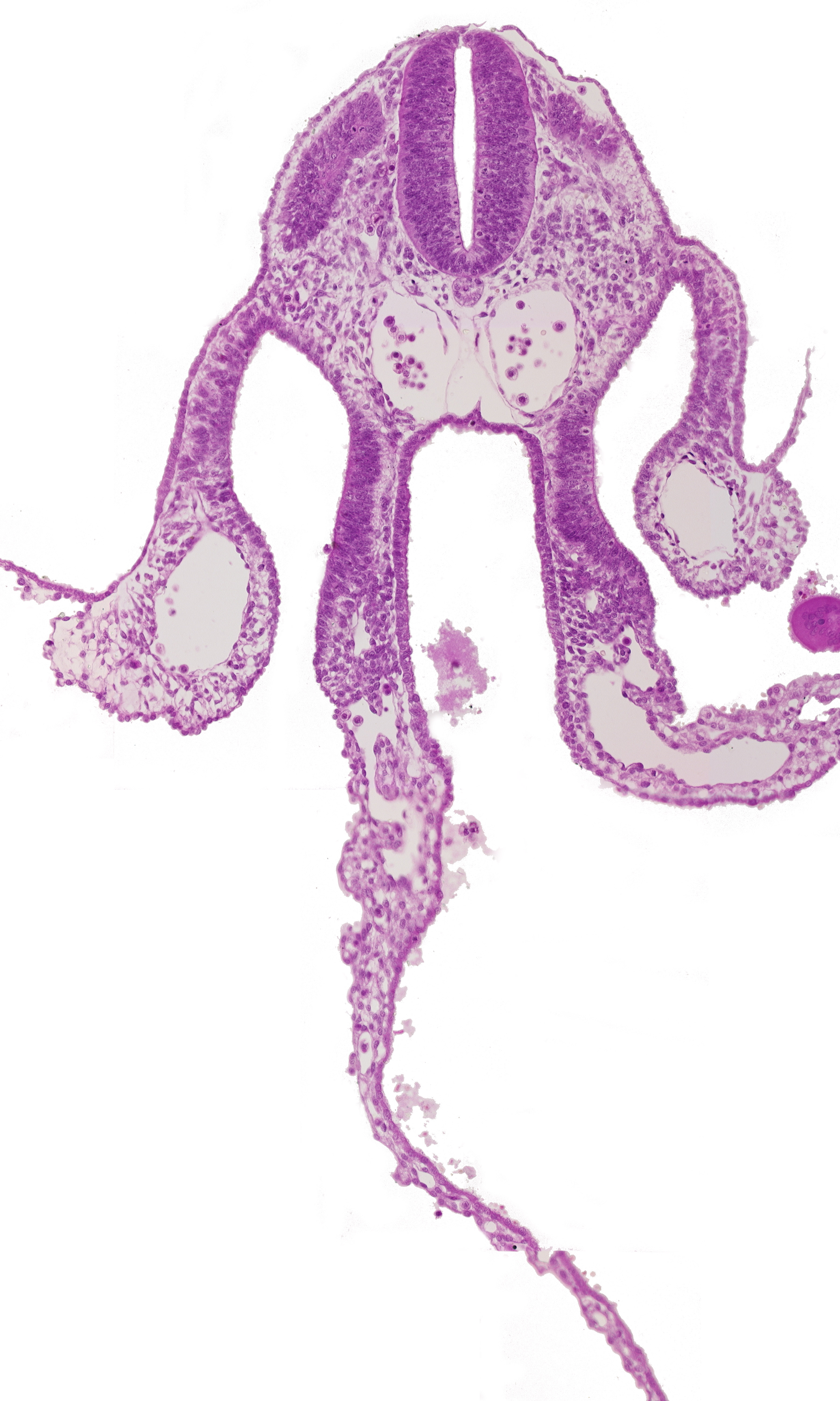 amnion attachment, caudal edge of dermatomyotome 7 (C-3), midgut, notochord, peritoneal cavity, primary umbilical vesicle stalk, right umbilical vein, specialized coelomic wall, surface ectoderm, umbilical vesicle cavity, umbilical vesicle wall