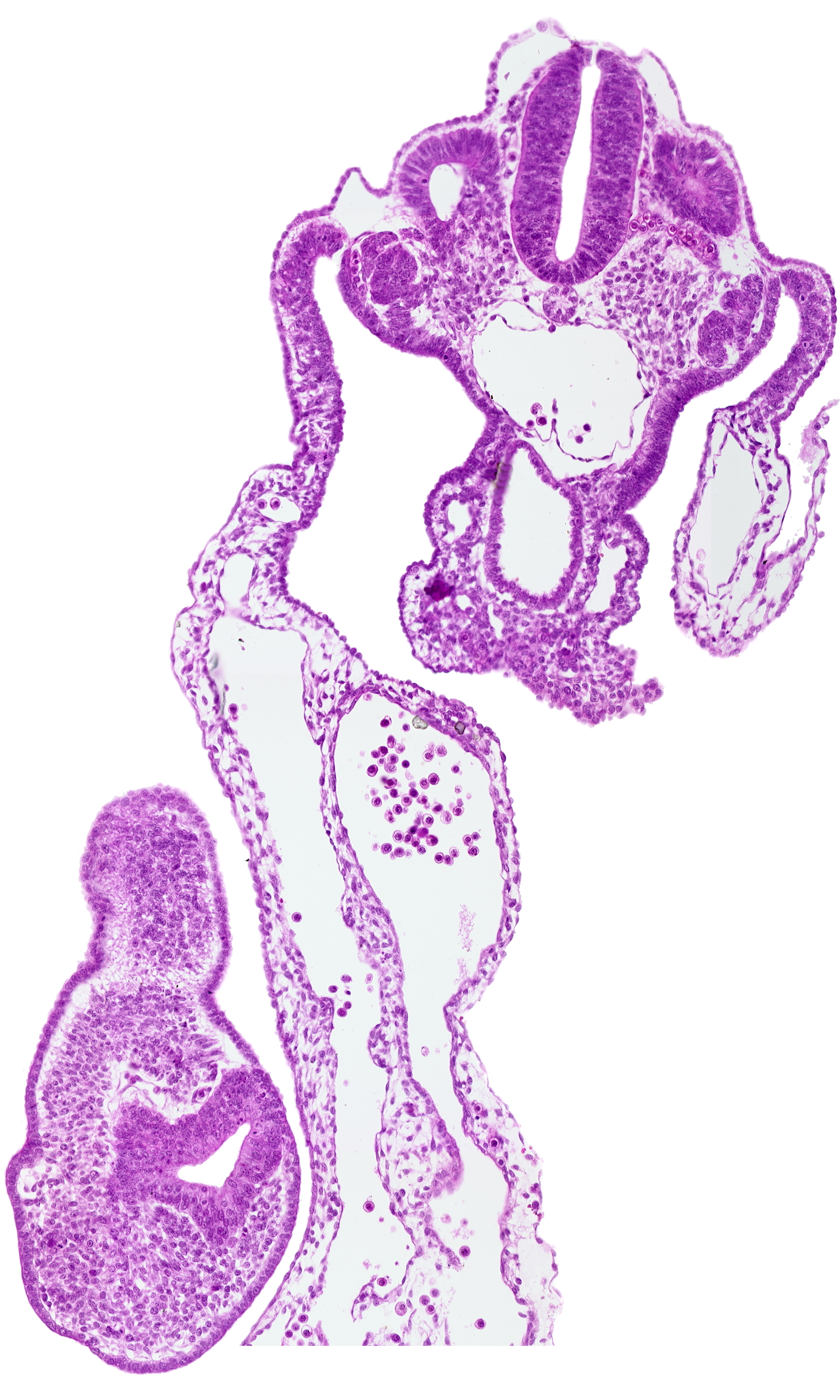 amnion attachment, aorta, caudal edge of cloacal lumen, caudal eminence, cloacal membrane, communication between peritoneal cavity and extra-embryonic coelomic cavity, dermatomyotome 12 (C-8), mesonephric duct, mesonephric vesicle(s)