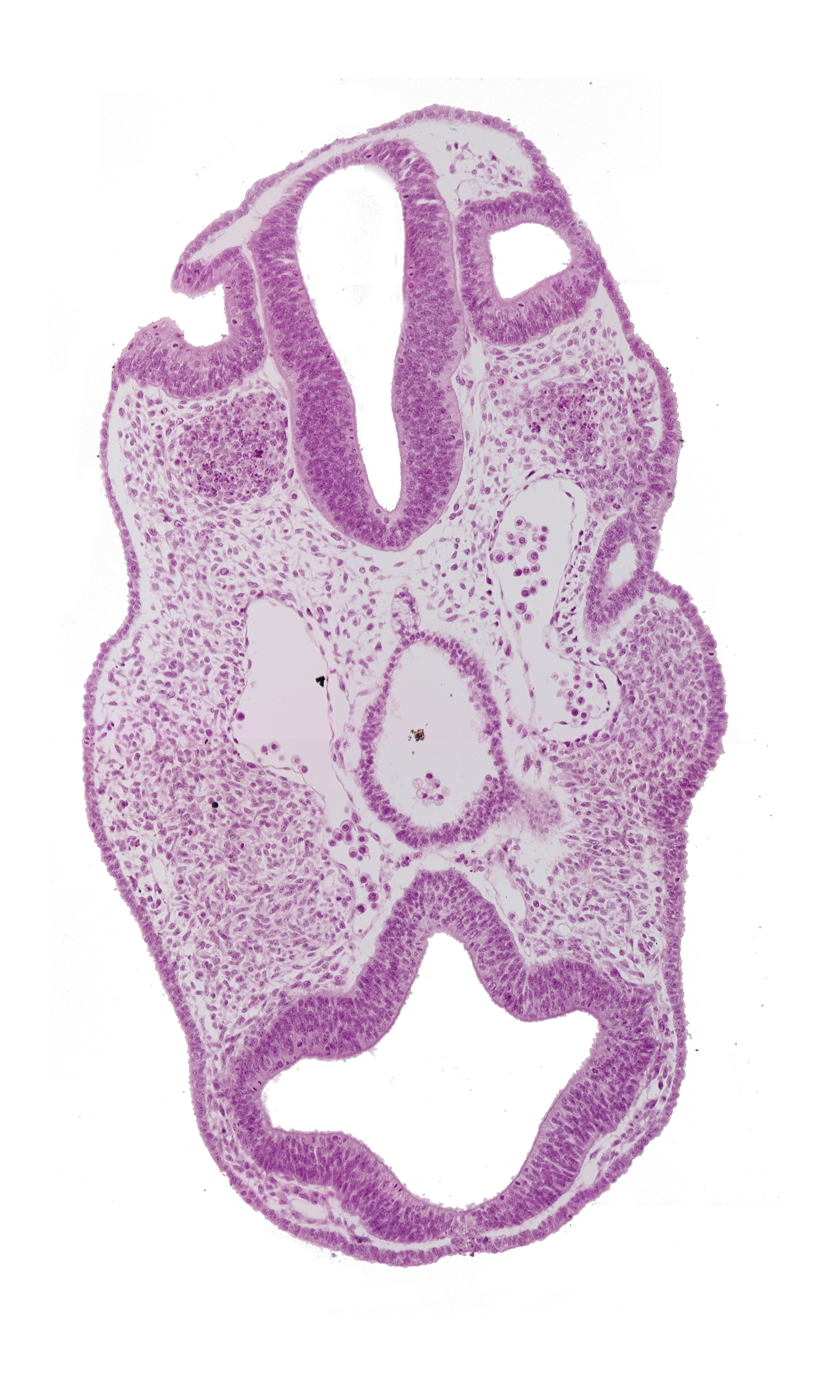 diencephalon (D1), diencephalon (D2), dorsal aorta, facio-vestibulocochlear neural crest (CN VII and CN VIII), internal carotid artery, intraretinal space (optic vesicle cavity), nasal disc (olfactory placode), neuropore site, notochord, optic vesicle (D1), otic vesicle, pharyngeal arch 1, pharyngeal groove 1, pharyngeal pouch 1, pharynx, prosencoel (third ventricle), rhombencephalon (Rh. 4), rhombencephalon (Rh. 5), telencephalon medium (T)