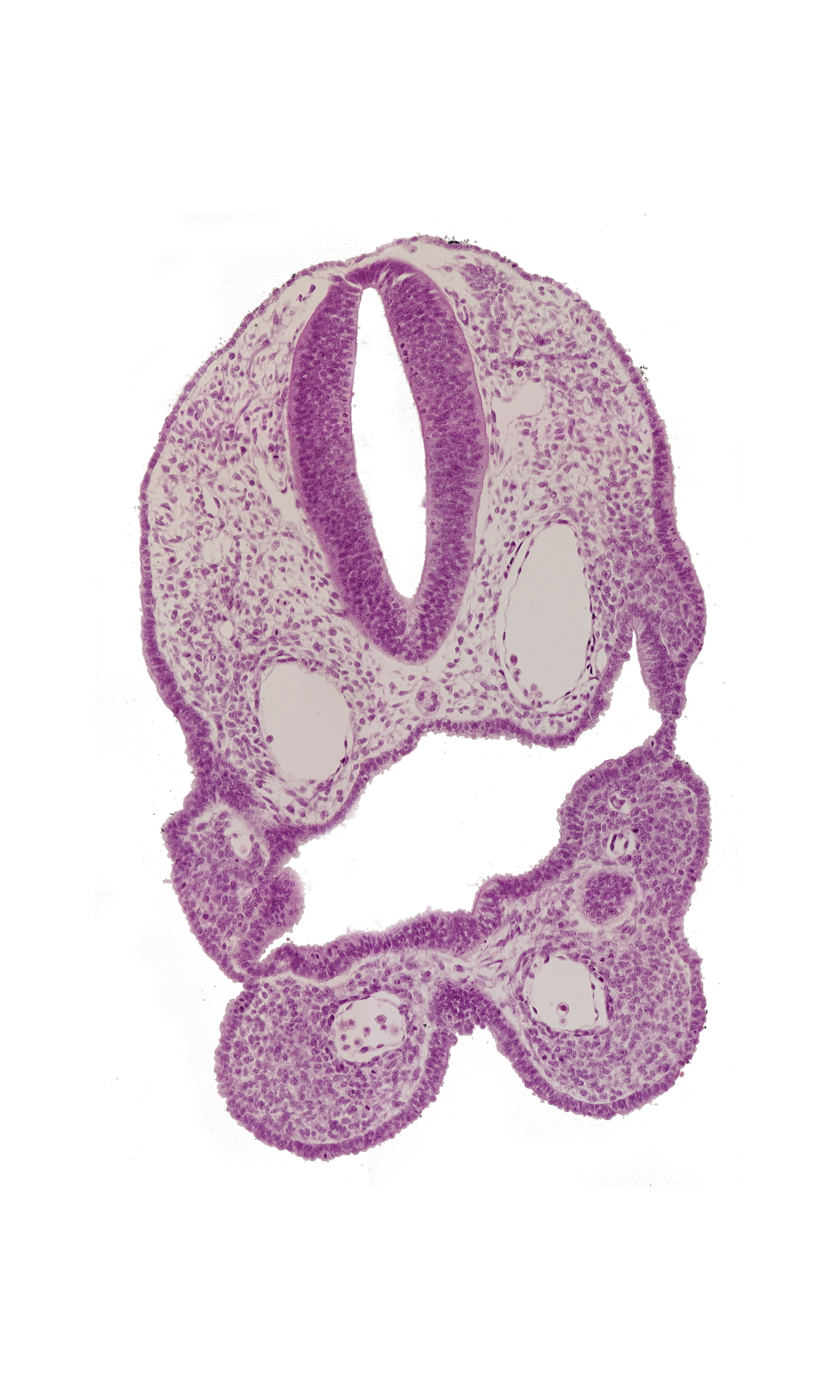 aortic arch 1, aortic arch 2, dorsal aorta, ectodermal ring, head mesenchyme, median mandibular groove, notochord, pharyngeal membrane 2, pharyngeal pouch 2, pharynx
