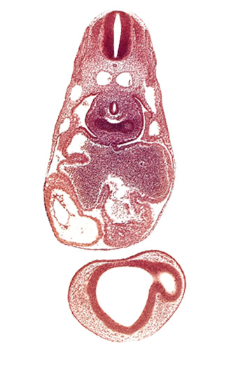 common atrioventricular canal, common cardinal vein, dermatomyotome 7 (C-3), epimyocardium, esophagus primordium, intraretinal space (optic vesicle cavity), left atrium, left lung bud, notochord, pericardial cavity, pericardioperitoneal canal (pleural cavity), postcardinal vein, prosencoel (third ventricle), right atrium, right lung bud, sinu-atrial foramen, sinus venosus, ventral thalamus (diencephalon)