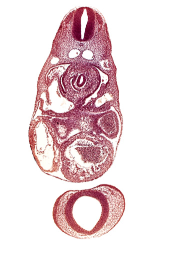 C-3 spinal ganglion primordium, dermatomyotome 7 (C-3), dorsal aorta, endocardium, left atrium, left common cardinal vein, lesser  sac, notochord, postcardinal vein, prosencephalon (telencephalic part), prosencoel (third ventricle), sinus venosus, trabecular part of left ventricle