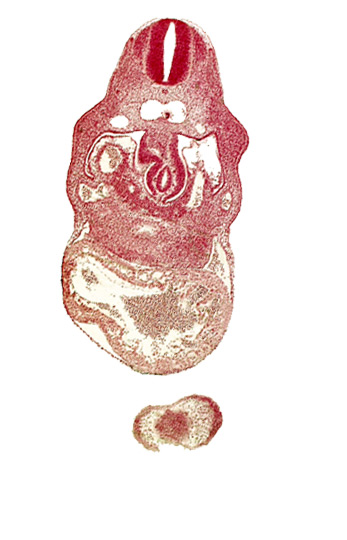 anterior interventricular sulcus, caudal edge of sinus venosus, dermatomyotome 8 (C-4), hepatic lamina(e), hepatic sinusoid, hepatocardiac vein, interventricular foramen, junction of left and right dorsal aortas, lamina terminalis of prosencephalon, nasal disc (olfactory placode), notochord, right umbilical vein, upper limb bud