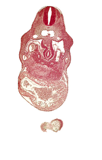 anterior interventricular sulcus, cephalic part of head, hepatic lamina(e), hepatic sinusoid, hepatocardiac vein, notochord, right umbilical vein, united dorsal aortas, upper limb bud