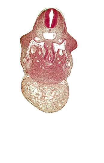 alar plate(s), basal plate, common aorta, duodenum primordium, hepatic lamina(e), hepatic sinusoid, left ventricle, notochord, postcardinal vein, right ventricle, septum transversum, specialized coelomic wall, upper limb bud