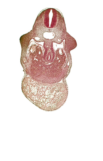 alar plate(s), basal plate, coelomic cavity, common aorta, duodenum primordium, hepatic lamina(e), hepatic sinusoid, notochord, postcardinal vein, septum transversum, specialized coelomic wall, upper limb bud