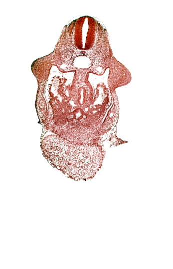 alar plate(s), amnion attachment, basal plate, coelomic cavity, common aorta, common ventricle, dorsal pancreatic bud, duodenum primordium, hepatic antrum, hepatocardiac vein, left umbilical vein, postcardinal vein, septum transversum, upper limb bud