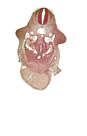 alar plate(s), amnion attachment, basal plate, coelomic cavity, common aorta, common ventricle, dorsal pancreatic bud, duodenum primordium, hepatic antrum, hepatocardiac vein, left umbilical vein, postcardinal vein, septum transversum, upper limb bud