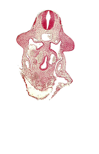 amnion attachment, aorta, apical ectodermal ridge, dermatomyotome 9 (C-5), duodenum primordium, hepatic antrum, marginal layer, notochord, postcardinal vein, sulcus limitans, upper limb bud