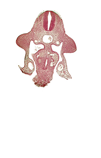 amnion attachment, aorta, coelomic cavity, communication of coelomic cavity with extra-embryonic coelom, duodenum primordium, junction of hepatocardiac and left vitelline veins, marginal layer, notochord, postcardinal vein, sulcus limitans, upper limb bud, vitelline (omphalomesenteric) vein