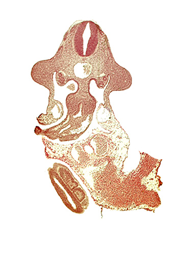 allantois, aorta, coelomic cavity, common umbilical vein, dermatomyotome 11 (C-7), floor plate, left umbilical artery, left umbilical vein, left vitelline (omphalomesenteric) vein, marginal layer, mesentery proper, mesonephric duct, midgut, neural tube, omphaloenteric duct, paraxial mesoderm, postcardinal vein, right umbilical artery, right umbilical vein, roof plate, somite 31 (S-2), somite 32 (S-3), upper limb bud