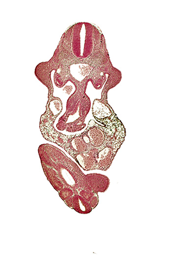 alar plate(s), aorta, basal plate, caudal edge of cloaca, caudal eminence, coelomic cavity, dermatomyotome 11 (C-7), left umbilical artery, left umbilical vein, lower limb bud, mesonephric duct, mesonephros, neural canal, notochord, somite 30 (S-1), somite 31 (S-2), sulcus limitans, upper limb bud