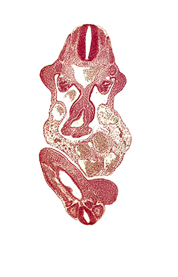 abdominal wall, allantois, aorta, caudal eminence, cloaca, dermatomyotome 11 (C-7), intersegmental artery, left umbilical artery, lower limb bud, mesonephric duct, origin of primary intestinal plexus artery, somite 29 (L-5), somite 30 (S-1), somite 31 (S-2), upper limb bud