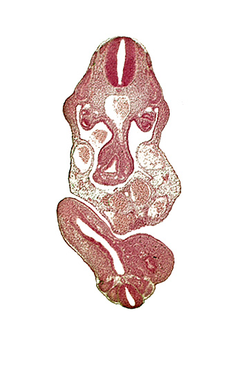 abdominal wall, aorta, dermatomyotome 11 (C-7), dermatomyotome 12 (C-8), edge of coelom, junction of cloaca and mesonephric duct, mesonephric duct, notochord, postcardinal vein, somite 29 (L-5), subcardinal vein