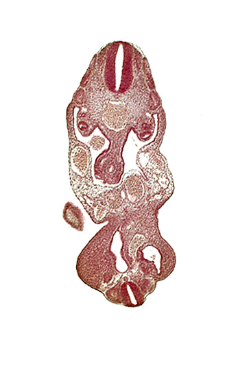 T-1 spinal ganglion primordium, aorta, cloaca, coelom, dermatomyotome 13 (T-1), edge of caudal eminence, left umbilical artery, left umbilical vein, lower limb bud, mesonephric duct, notochord, right umbilical vein