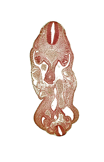 T-1 spinal ganglion primordium, aorta, coelom, dermatomyotome 13 (T-1), dermatomyotome 14 (T-2), dermatomyotome 27 (L-3), gonadal epithelium, hindgut, junction of allantois and urogenital sinus, left common iliac artery, left umbilical artery, lower limb bud, mesonephric ridge, neural canal, notochord, origin of primary intestinal plexus artery, rectum primordium, sclerotome, urogenital sinus, urorectal septum