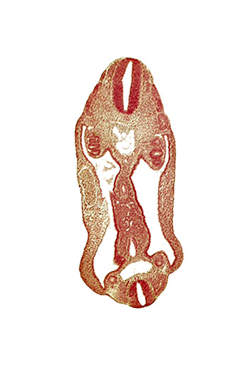 aorta, aortic bifurcation, coelom, dermatomyotome 15 (T-3), dermatomyotome 26 (L-2), hindgut, mesentery, neural tube, notochord