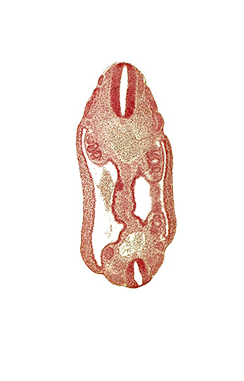 aorta, coelom, dermatomyotome 16 (T-4), dermatomyotome 17 (T-5), dermatomyotome 25 (L-1), mesonephric duct, mesonephric vesicle(s), mesothelium, neural tube, notochord, sclerotome, somatic mesoderm, splanchnic mesoderm