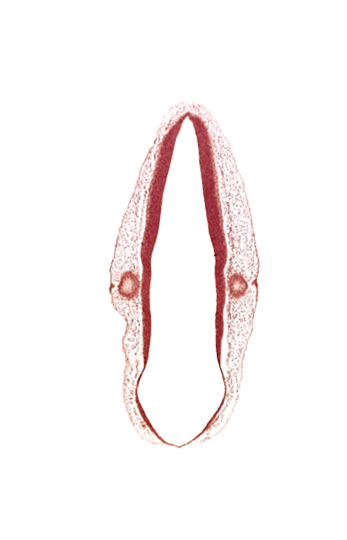 alar plate of rhombencephalon, ectodermal tag of otic vesicle, otic vesicle, rhombencoel (fourth ventricle), roof plate of rhombencephalon