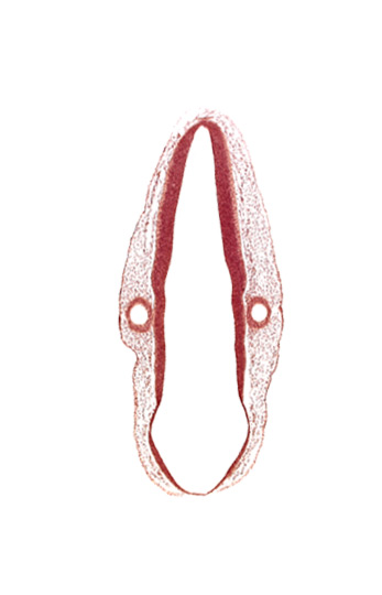 head mesenchyme, mantle layer, marginal layer, otic vesicle, otic vesicle cavity, rhombencoel (fourth ventricle), rhombomere 6, surface ectoderm, venous plexus(es)