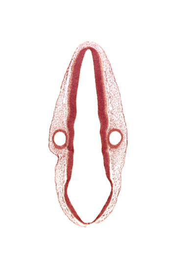 head mesenchyme, mantle layer, marginal layer, otic vesicle, otic vesicle cavity, posterior dural venous plexus, rhombencoel (fourth ventricle), rhombomere 6, roof plate, surface ectoderm