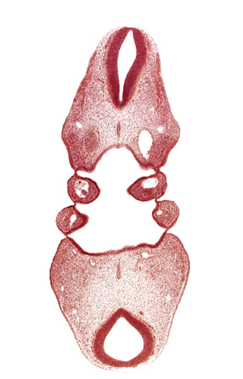 aortic arch 3, dorsal aorta (aortic arch 4), internal carotid artery, notochord, region of mesencephalic (cephalic) flexure