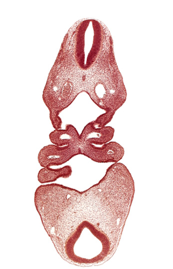 aortic arch 2, dermatomyotome 4 (O-4) , dermatomyotome 5 (C-1), dorsal aorta, junction of rhombencephalon and spinal cord, mandibular prominence of pharyngeal arch 1, notochord, pharyngeal arch 2, pharyngeal pouch 1, precardinal vein, thyroid diverticulum